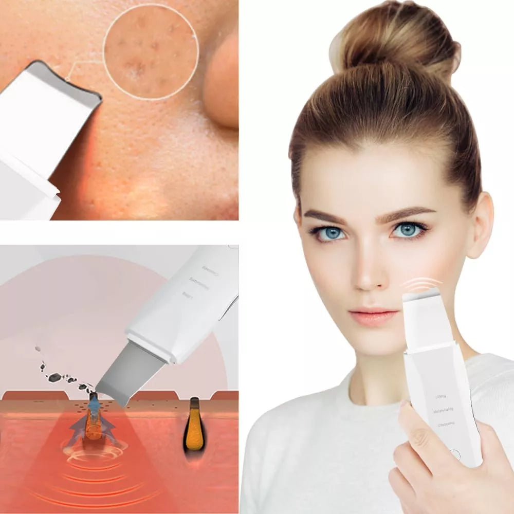 Limpiador Ultrasónico MultiPeel Power®